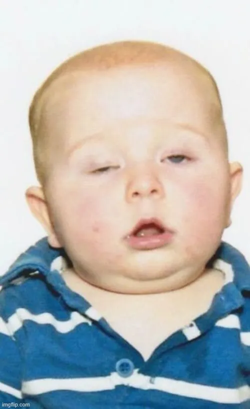 Meme chế ngáp che mặt giữa buổi họp dài