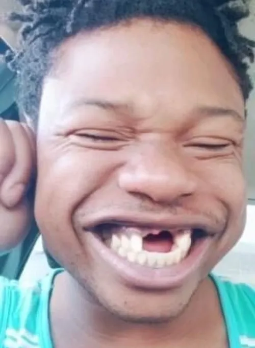 Meme cười nhe răng lan tỏa niềm vui tươi sáng