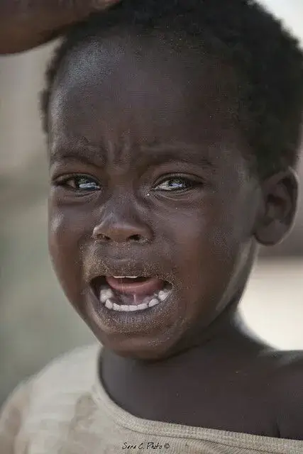 13 Em bé da đen khóc rất đau khổ