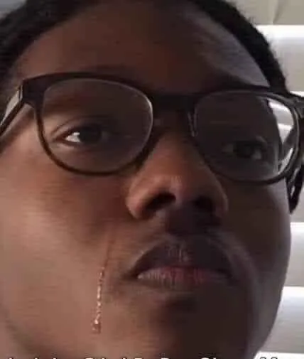 4 Ảnh vui người đàn ông da đen cố cười trong đau khổ