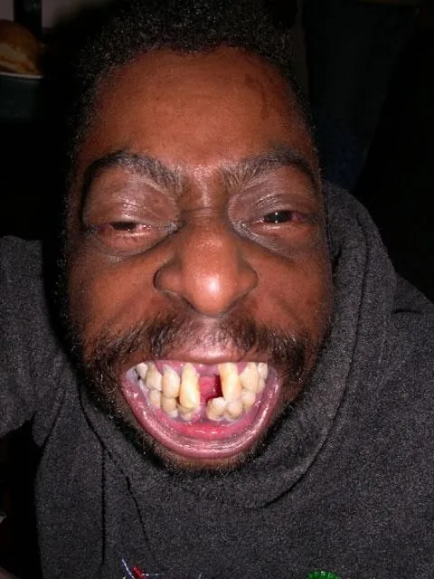 Biểu cảm nhe răng cười siêu dễ thương và hài.