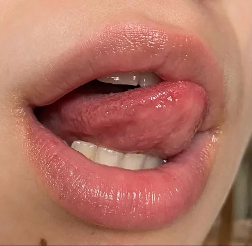 Hình troll đôi môi khẽ cắn trong caption “thích mà ngại”